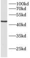UDP-GlcNAc:betaGal beta-1,3-N-acetylglucosaminyltransferase 5 antibody, FNab00769, FineTest, Western Blot image 