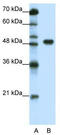 Transcription Factor AP-2 Alpha antibody, TA330109, Origene, Western Blot image 