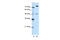Small RNA Binding Exonuclease Protection Factor La antibody, 29-309, ProSci, Western Blot image 
