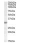 RAB23, Member RAS Oncogene Family antibody, NBP1-20965, Novus Biologicals, Western Blot image 