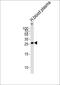 Complement C1q B Chain antibody, PA5-35369, Invitrogen Antibodies, Western Blot image 