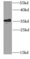 Potassium Channel Tetramerization Domain Containing 15 antibody, FNab04505, FineTest, Western Blot image 