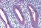 Ribosomal Protein L22 antibody, GTX88916, GeneTex, Immunohistochemistry paraffin image 
