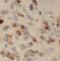 Trefoil Factor 1 antibody, FNab08958, FineTest, Immunohistochemistry paraffin image 