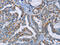 Glycoprotein A33 antibody, CSB-PA055320, Cusabio, Immunohistochemistry paraffin image 