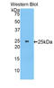 Myosin Heavy Chain 8 antibody, LS-C295492, Lifespan Biosciences, Western Blot image 