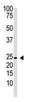 Interferon Lambda 1 antibody, AP11658PU-N, Origene, Western Blot image 