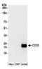 CD3d Molecule antibody, A305-169A, Bethyl Labs, Western Blot image 