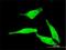 Cytosolic purine 5 -nucleotidase antibody, H00022978-M02, Novus Biologicals, Immunofluorescence image 