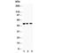 Muscarinic acetylcholine receptor M2 antibody, R30388, NSJ Bioreagents, Western Blot image 