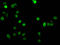 Histone Cluster 1 H1 Family Member E antibody, LS-C670365, Lifespan Biosciences, Immunofluorescence image 