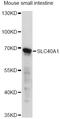 SLC40A1 antibody, A14884, ABclonal Technology, Western Blot image 