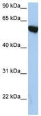 Amyloid Beta Precursor Protein Binding Family A Member 3 antibody, TA330418, Origene, Western Blot image 