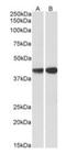 Capping Actin Protein, Gelsolin Like antibody, orb178390, Biorbyt, Western Blot image 
