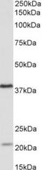 Kelch Domain Containing 8B antibody, TA311594, Origene, Western Blot image 