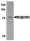 Nibrin antibody, TA326620, Origene, Western Blot image 