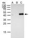 Forkhead box protein E1 antibody, GTX100275, GeneTex, Immunoprecipitation image 