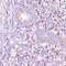 cAMP-dependent protein kinase catalytic subunit beta antibody, 19-588, ProSci, Immunohistochemistry paraffin image 