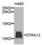 Centromere Protein X antibody, A9892, ABclonal Technology, Western Blot image 