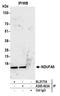 NADH:Ubiquinone Oxidoreductase Subunit A5 antibody, A305-463A, Bethyl Labs, Immunoprecipitation image 