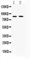 MUT antibody, PA5-79708, Invitrogen Antibodies, Western Blot image 