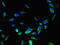 Dyslexia susceptibility 1 candidate gene 1 protein antibody, CSB-PA855504LA01HU, Cusabio, Immunofluorescence image 