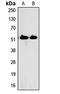 Serine Palmitoyltransferase Long Chain Base Subunit 1 antibody, LS-C368626, Lifespan Biosciences, Western Blot image 