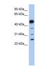 Hematopoietic Prostaglandin D Synthase antibody, NBP1-54625, Novus Biologicals, Western Blot image 