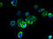 Transmembrane Protein 256 antibody, A61410-100, Epigentek, Immunofluorescence image 