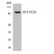 Rabenosyn, RAB Effector antibody, LS-C292217, Lifespan Biosciences, Western Blot image 