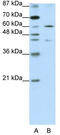 Zinc finger protein 496 antibody, TA345453, Origene, Western Blot image 