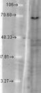 Potassium Voltage-Gated Channel Subfamily Q Member 1 antibody, GTX41988, GeneTex, Western Blot image 