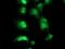 TP53RK Binding Protein antibody, MA5-26384, Invitrogen Antibodies, Immunocytochemistry image 