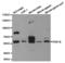 Phosphodiesterase 1B antibody, TA327270, Origene, Western Blot image 