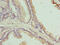 Chromosome 17 Open Reading Frame 64 antibody, CSB-PA771458LA01HU, Cusabio, Immunohistochemistry paraffin image 