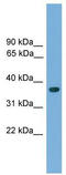 Homeobox protein Hox-A1 antibody, TA342266, Origene, Western Blot image 