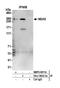 Neuroblastoma-amplified sequence antibody, NBP2-59114, Novus Biologicals, Western Blot image 