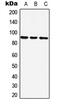 Zinc Finger Protein 25 antibody, GTX56022, GeneTex, Western Blot image 