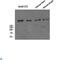 Complement C3b/C4b Receptor 1 (Knops Blood Group) antibody, LS-C813296, Lifespan Biosciences, Western Blot image 