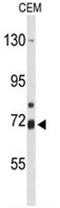 Arachidonate 15-Lipoxygenase Type B antibody, AP50153PU-N, Origene, Western Blot image 