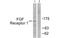 FGFR-2 antibody, MBS5300454, MyBioSource, Western Blot image 