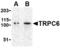 Short transient receptor potential channel 6 antibody, MBS151075, MyBioSource, Western Blot image 