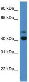 Opsin 1, Short Wave Sensitive antibody, TA342776, Origene, Western Blot image 