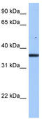 Family With Sequence Similarity 153 Member B antibody, TA339983, Origene, Western Blot image 