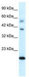 BolA Family Member 1 antibody, TA329894, Origene, Western Blot image 