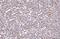 DAB2 antibody, A01546-3, Boster Biological Technology, Immunohistochemistry paraffin image 