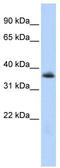 Motor neuron and pancreas homeobox protein 1 antibody, TA329705, Origene, Western Blot image 