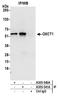 3-Oxoacid CoA-Transferase 1 antibody, A305-541A, Bethyl Labs, Immunoprecipitation image 