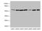 Fumarate Hydratase antibody, A62594-100, Epigentek, Western Blot image 