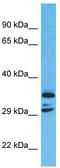 Chromosome 11 Open Reading Frame 65 antibody, TA338878, Origene, Western Blot image 